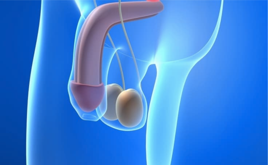 Trattamento chirurgico della curvatura del pene